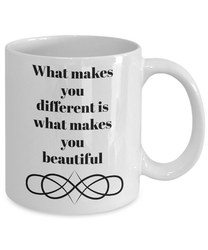 What makes you different is what makes you beautiful-motivational-coffee mug-tea cup-novelty friends