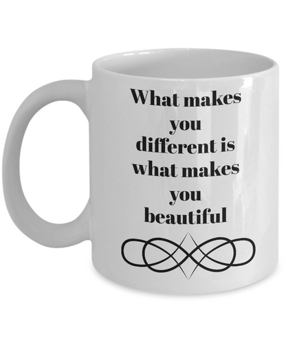 What makes you different is what makes you beautiful-motivational-coffee mug-tea cup-novelty friends